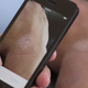 Illustration for article titled Need a Professional Opinion on That Scary Dick Rash? Use This App!